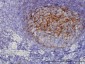 QPRT Antibody (monoclonal) (M01)